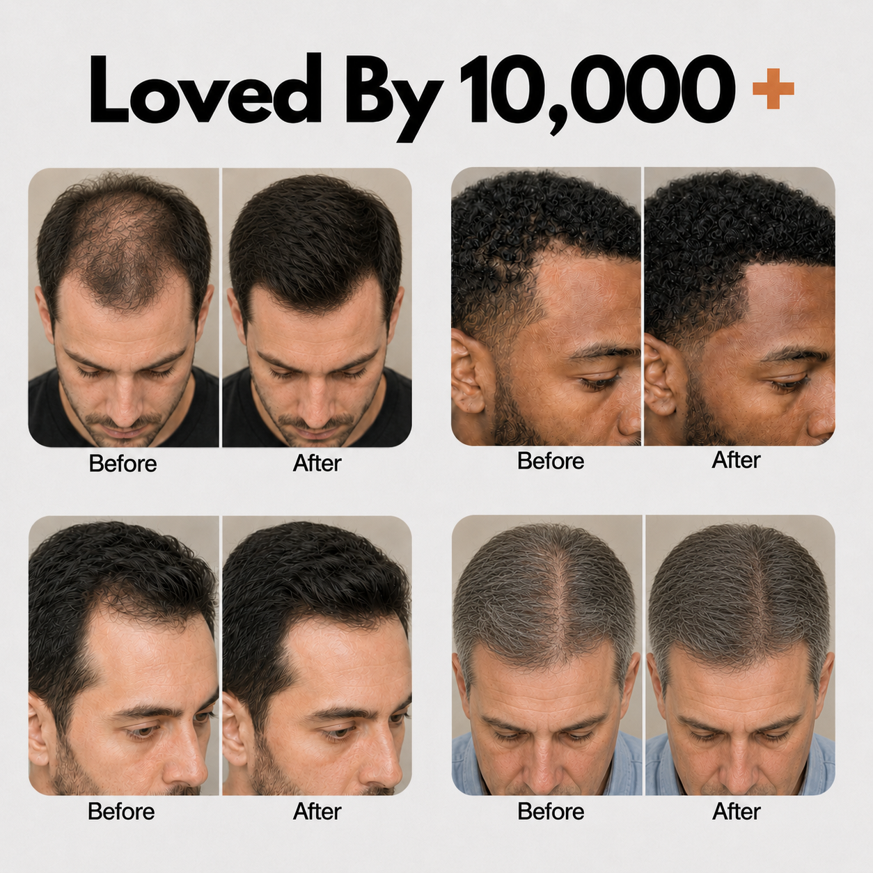 Korea's #1 Hair Growth Serum Mans