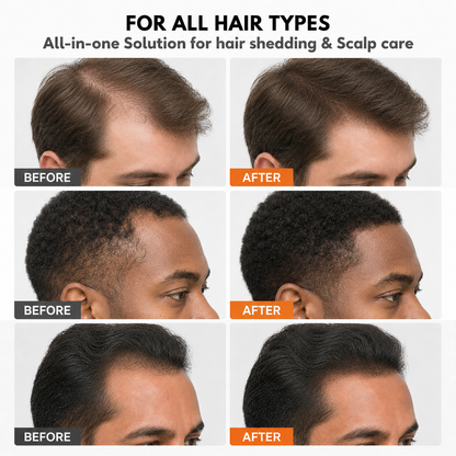 Korea's #1 Hair Growth Serum Mans